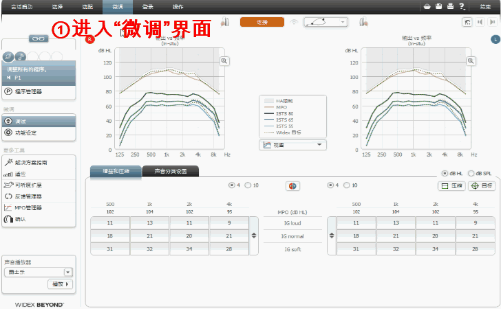 1分钟搞定助听器增益调节(图25)