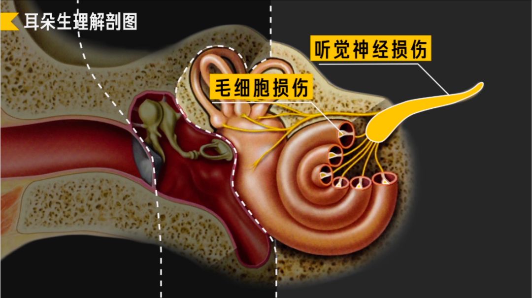 助听器如何拯救耳聋(图9)