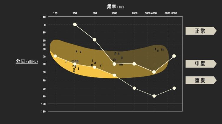 助听器如何拯救耳聋(图23)