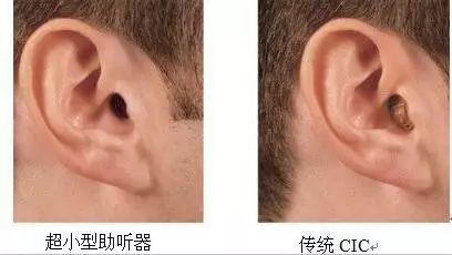 助听器佩戴要趁早 越晚佩戴助听效果越差(图1)