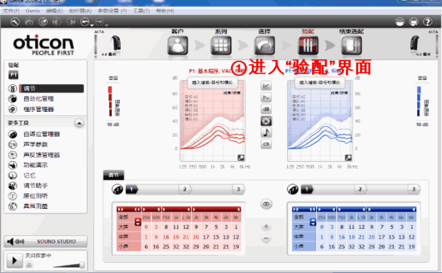 日常助听器验配中容易忽略的MPO调节(图21)