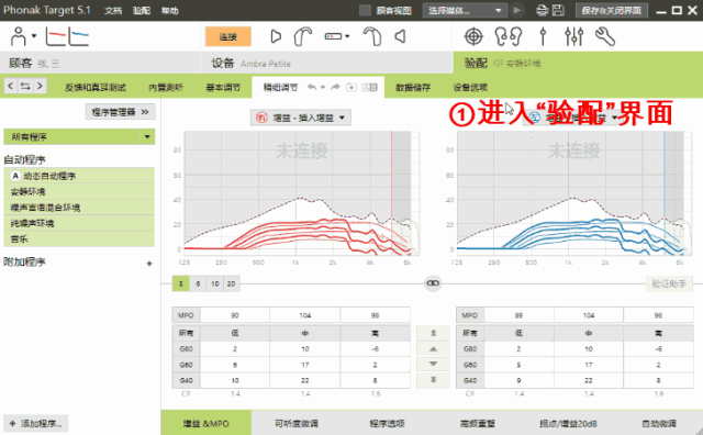 日常助听器验配中容易忽略的MPO调节(图22)
