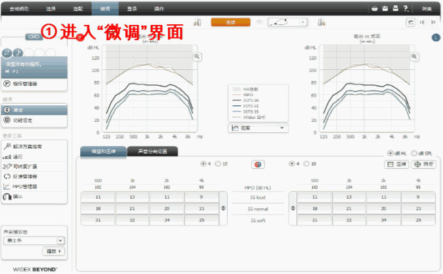 日常助听器验配中容易忽略的MPO调节(图25)