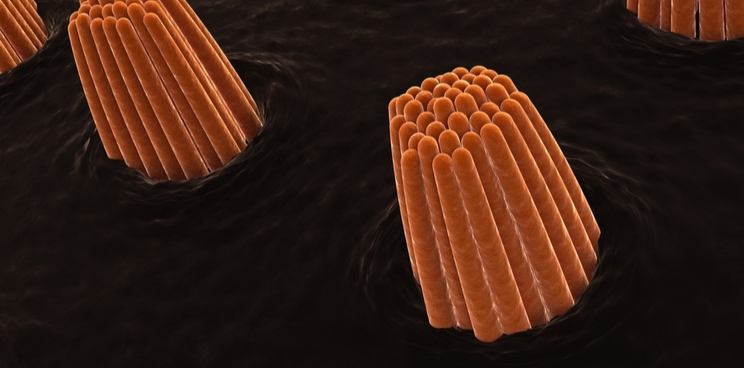 受疫情影响 Sensorion公司暂缓听力损失患者II期试验(图1)