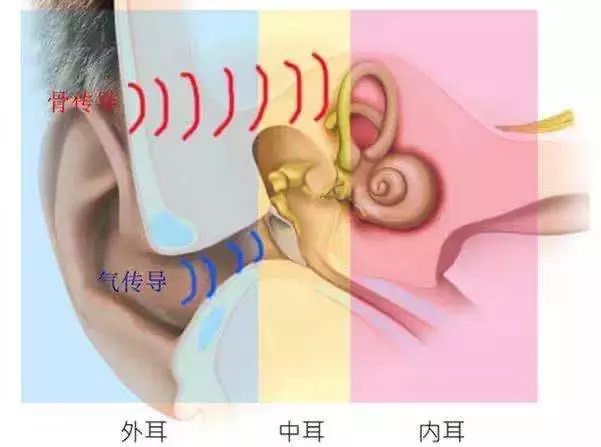 什么是骨导助听器?什么样的听力适合佩戴骨导助听器?(图1)
